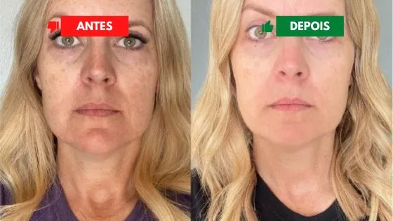 depoimento_2