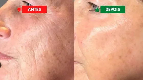 depoimento_6